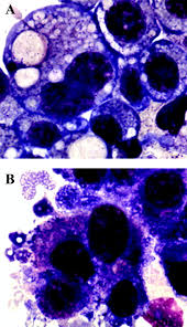 Image result for Rickettsiae