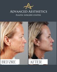 Advanced Aesthetics Plastic Surgery Center