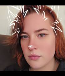 Can stereoviewers help people with stereo vision issues?