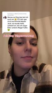 Antwort auf @Sabrina Milch & Update 🥺 #neonail #uvlack #allergie #fyp...