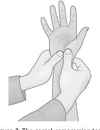 Image result for Carpal Compression Test