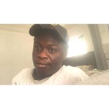 Compl!cations develop after a hair transplantation procedure. Quick  recovery.🙏🏻