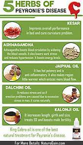 Men Health Herbal Treatment A Listly List
