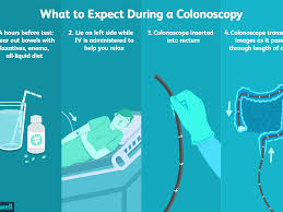 You have any of these things after having a colonoscopy: Colonoscopy Overview