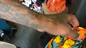 Listed at 6 feet 6 inches. Eagles Mills To Adorn Gronk Scar With Super Bowl Tattoo Philadelphia Eagles Blog Espn