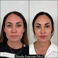 ScottsdaleSmilePartner You can't be an energetic, social, confident version  of yourself if you're waking up in pain or running