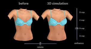 Vectra 3 D Imaging For Naples Fort Myers Fl Kent V Hasen Md Aesthetic Plastic Surgery Med Spa Of Naples