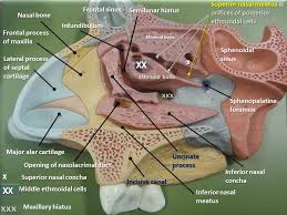 The nasal septum has been removed: Nose And Paranasal Sinuses Anatomy E Lab
