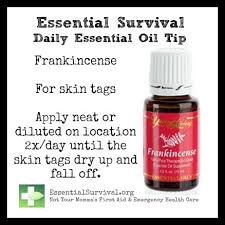 Use Frankincense For Skin Tags Essential Oils Essential Oils Health Essential Oils For Skin