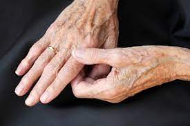 Gelenkschmerzen Im Finger Ursachen Behandlung Hilfe Medlexi De