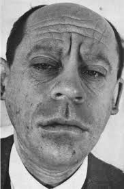 Ablagerungskrankheiten körpereigener Stoffwechselprodukte