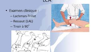 Les entorses du genou sont plus graves. Prise En Charge De L Entorse Grave Et Benigne Du Genou Youtube