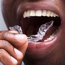 After gum surgery, it is important that the periodontist or dental hygienist inform you how to clean the teeth and gum tissue with a toothbrush and an there are different types of gum surgery depending on what you're experiencing and what exactly your periodontist is treating. Wearing A Retainer Will Protect Your New Smile After Braces Renew Dental Arts Llc