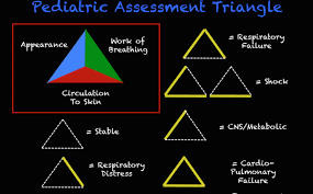Image result for Pediatric Assessment Triangle