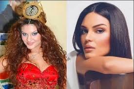 Almeda abazi estetiksiz haliyle şaşırttı geçen yıllarda survivor'da da yarışan almeda abazi'nin eski görüntülerinde kemerli burnu ve kilolu hali dikkat çekiyor. Almeda Abazi Nin Estetik Pismanligi Keske Yaptirmasaydim