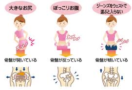 「骨盤の歪み 　イラスト」の画像検索結果