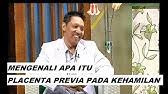 Semakin kecil maka semakin baik. Bagaimana Agar Plasenta Previa Atau Plasenta Dibawah Bisa Berputar Naik Keatas Dot Pande Youtube