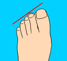 7 types of toes and the secrets they reveal about your