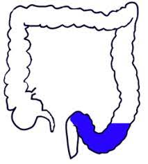 Want to learn more about it? Sigmoid Colon Wikipedia