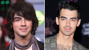 Joe Jonas habló de los retoques estéticos que se hizo en la cara para  combatir las arrugas a sus 33 años de edad