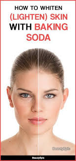 Pin On Home Remedies