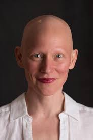What it means to be bald and beautiful for a woman