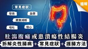 For faster navigation, this iframe is preloading the wikiwand page for 潰瘍性大腸炎. è…¸èƒƒå•é¡Œ è‚šç€‰è…¹ç—›æˆ–æ‚£æ½°ç˜æ€§çµè…¸ç‚Žæ‹†è§£ç‚Žæ€§è…¸ç—… å¸¸è¦‹ç—‡ç‹€ è­·è…¸æ–¹æ³• æ™´å ± å¥åº· è…¸èƒƒä¿å¥ D201120