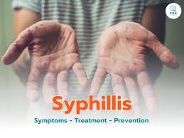 Image result for syphilis symptoms