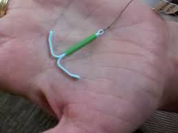 What is iud birth control? Aap Implants Iuds Best For Teen Birth Control Medpage Today