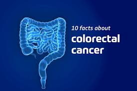 Image result for Colorectal Cancer