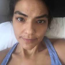 Fundraiser by Adele Arce : After-Care Fundraiser for Adele