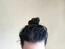 · impacchi o vaporizzazioni di tè sui capelli grassi; Capelli Grassi Cause E Rimedi