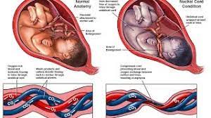Cordonul ombilical este un element important in dezvoltarea fatului, catre care asigura un sunt infasurari unice sau multiple ale cordonului in jurul unor segmente ale fatului (gat, trunchi, membre), cel mai frecvent in jurul gatului. Curiosities Cordon Ombilical In Jurul Gatului 1 Page 5 Wattpad