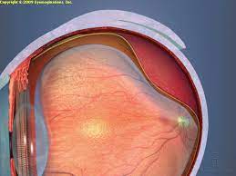 Pin On Retina