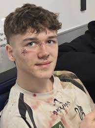 Richard Hanvey's Instagram, Twitter & Facebook