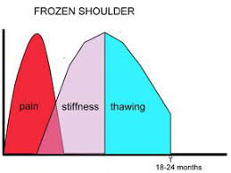 Image result for Shoulder History