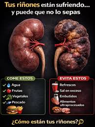 Tus riñones están sufriendo… y puede que no lo sepas ⚠️ Cada día, tu cuerpo  filtra toxinas, regula líquidos y mantiene todo en equilibrio… pero cuando  no te hidratas bien y comes