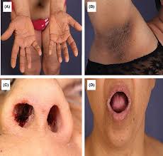 Image result for Thesium nigricans