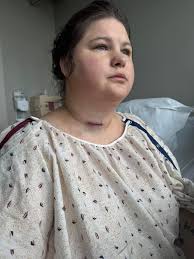 What are some creative ways to explain a neck scar from surgery?