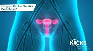 Nyeri panggul/sakit perut pada wanita. Kenali 4 Bahaya Kanker Serviks Pada Wanita