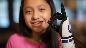 Was soll soll ich ausdrucken? 11 Jahriges Madchen Erhalt Star Wars Armprothese Aus Dem 3d Drucker