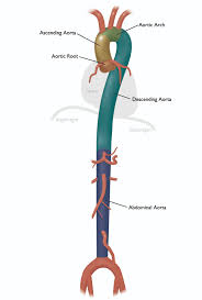 Vertebral_4_zone.jpg illustration for vascular injury book. Aorta Anatomy Uf Health Aortic Disease Center Diseases Treatment Uf Health University Of Florida Health