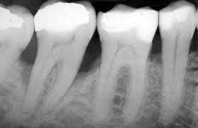More images for how many x rays are safe in a year » Safety Of X Rays Elstead Dental Surgery