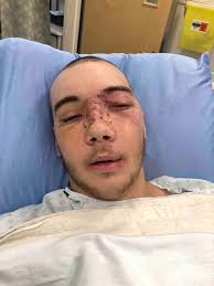 Fundraiser by Mari Pelly : AJ's Road To Recovery