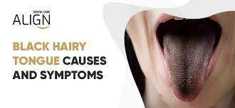 Image result for black hairy tongue symptoms
