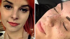Die 14jährige karoline und der 15jährige robbi, die früher mal im selben haus gewohnt haben, treffen sich in einem ferienlager wieder. Tatowierte Sommersprossen Fur Den Pipi Langstrumpf Look Stern De
