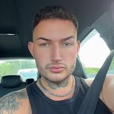 Best place to get lip filler????💋