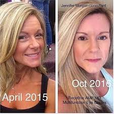 Good things take time but good skin comes right after the minute you decide  to take care of it.” “A beautiful skin is no miracle, but rather a  commitment.” “You hold the