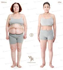 Pin On Korean Body Contouring Surgery
