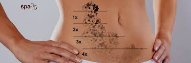 Maybe you would like to learn more about one of these? Tattoo Removal In Boise Idaho All Colors Spa 35 Med Spa Boise Id Spa 35